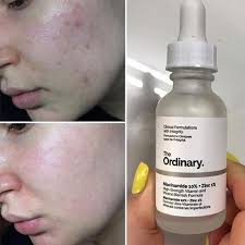 The Ordinary Face & Hand Brightening Glow kit